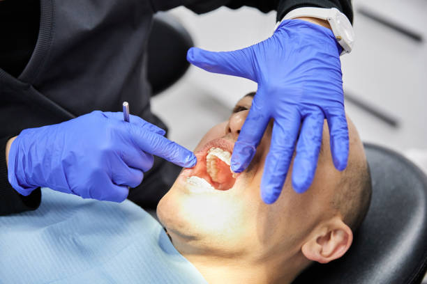 Best Emergency Dental Extractions in Bronson, FL